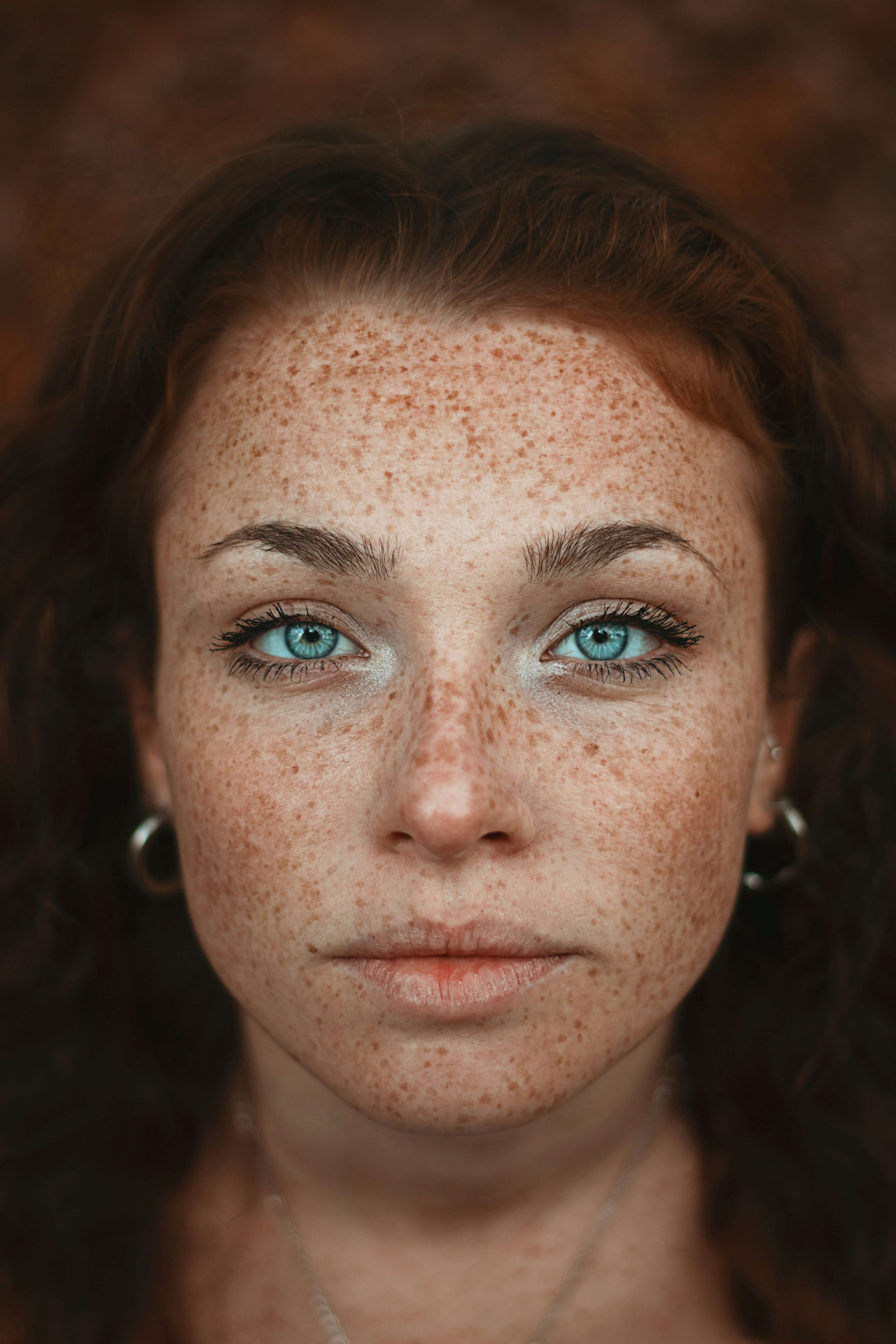 Lactic vs Glycolic Acid: Which Is Better for Sensitive Skin?
