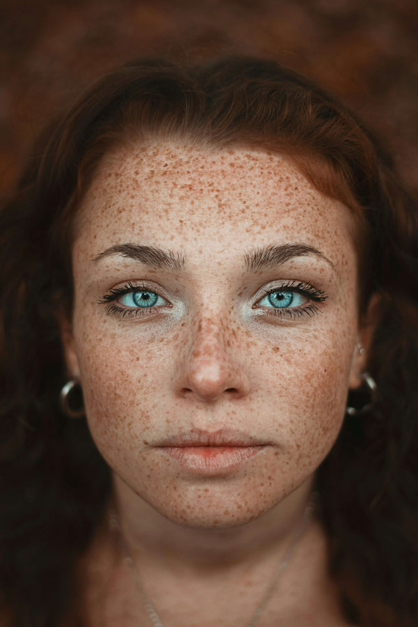 Lactic vs Glycolic Acid: Which Is Better for Sensitive Skin?